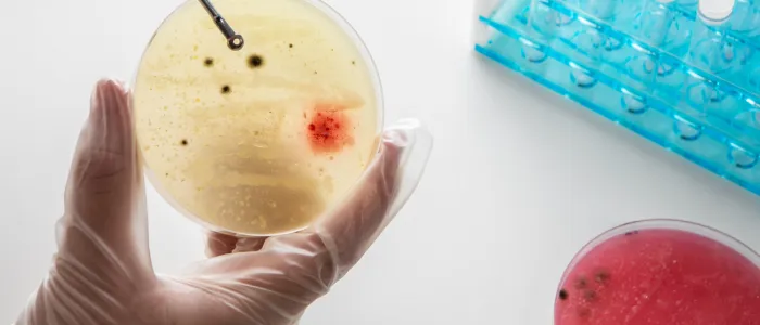 microbiological media
